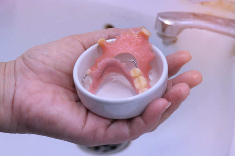 preparing-dentures-for-cleaning