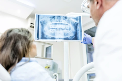 Digital dental x-rays at Ventana Family Dental in Katy, TX.